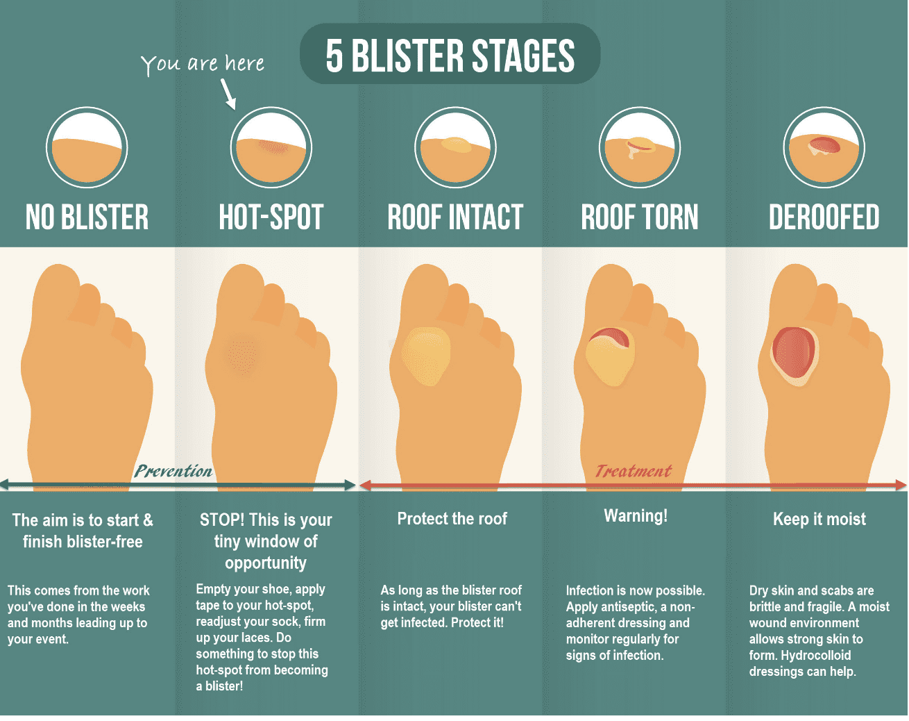 AMR Aid Station Running Blisters 101 Another Mother Runner